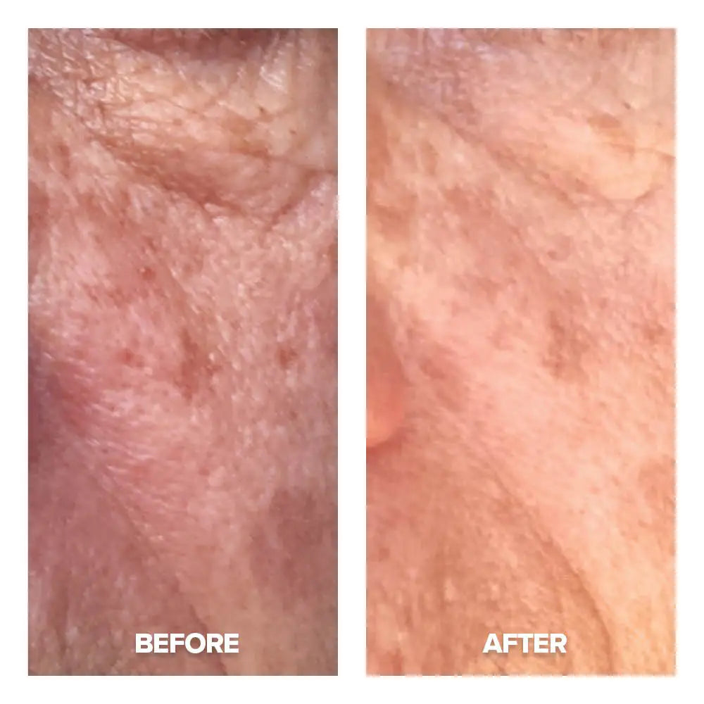 CC Cream Huidverzorgingsproduct